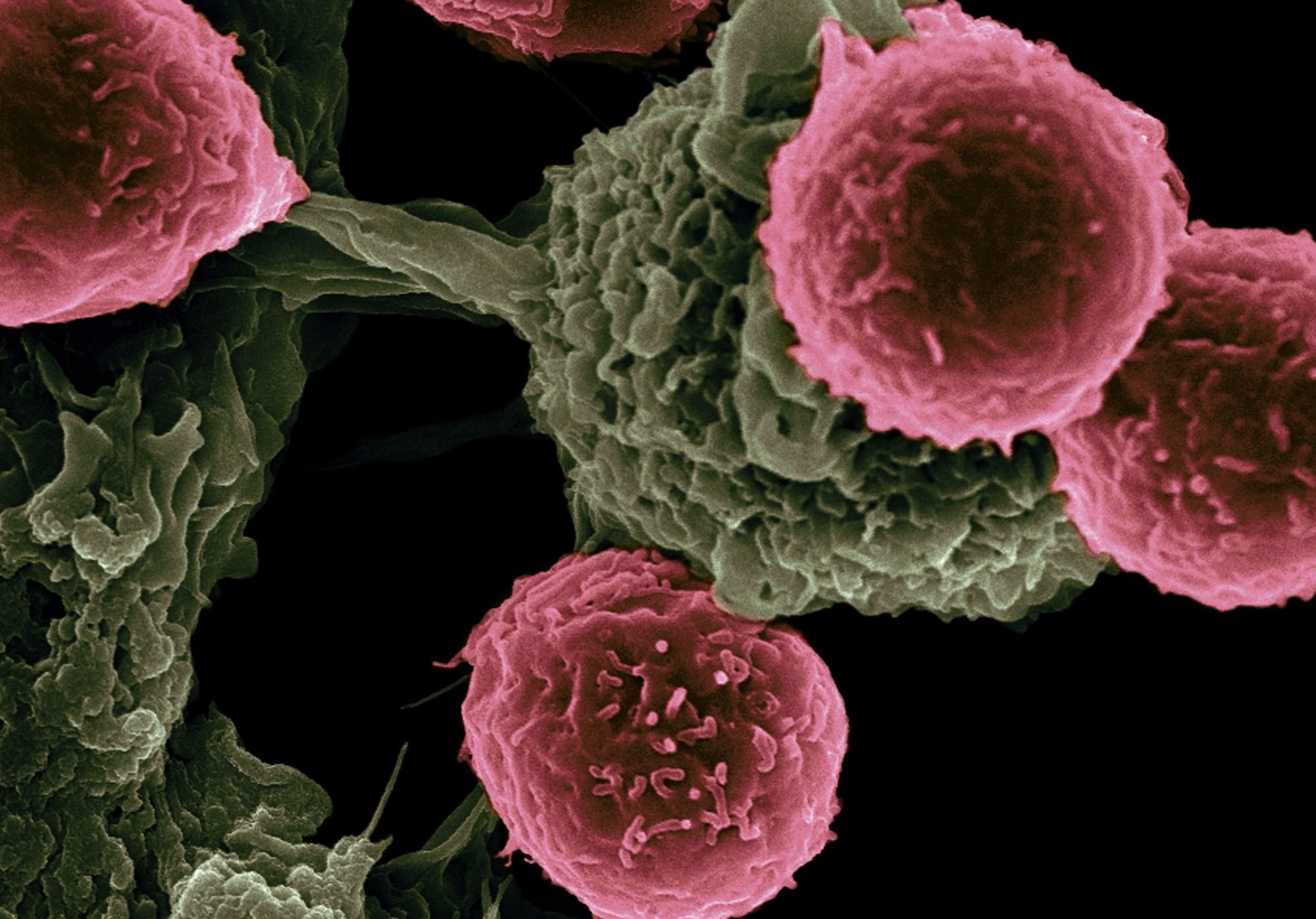 This Japanese Pharmaceutical Company Signed a $5.5 Billion Deal to Develop New Cancer Therapies